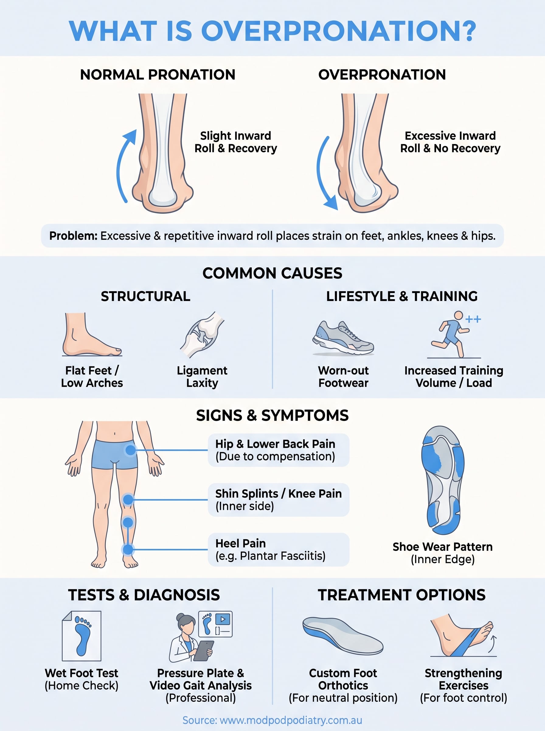 what is overpronation infographic