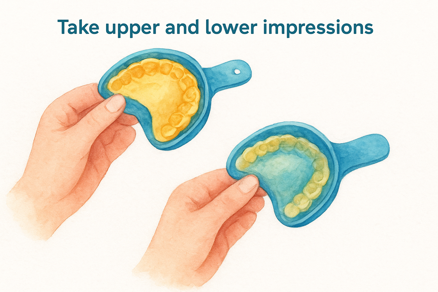 Take upper and lower impressions
