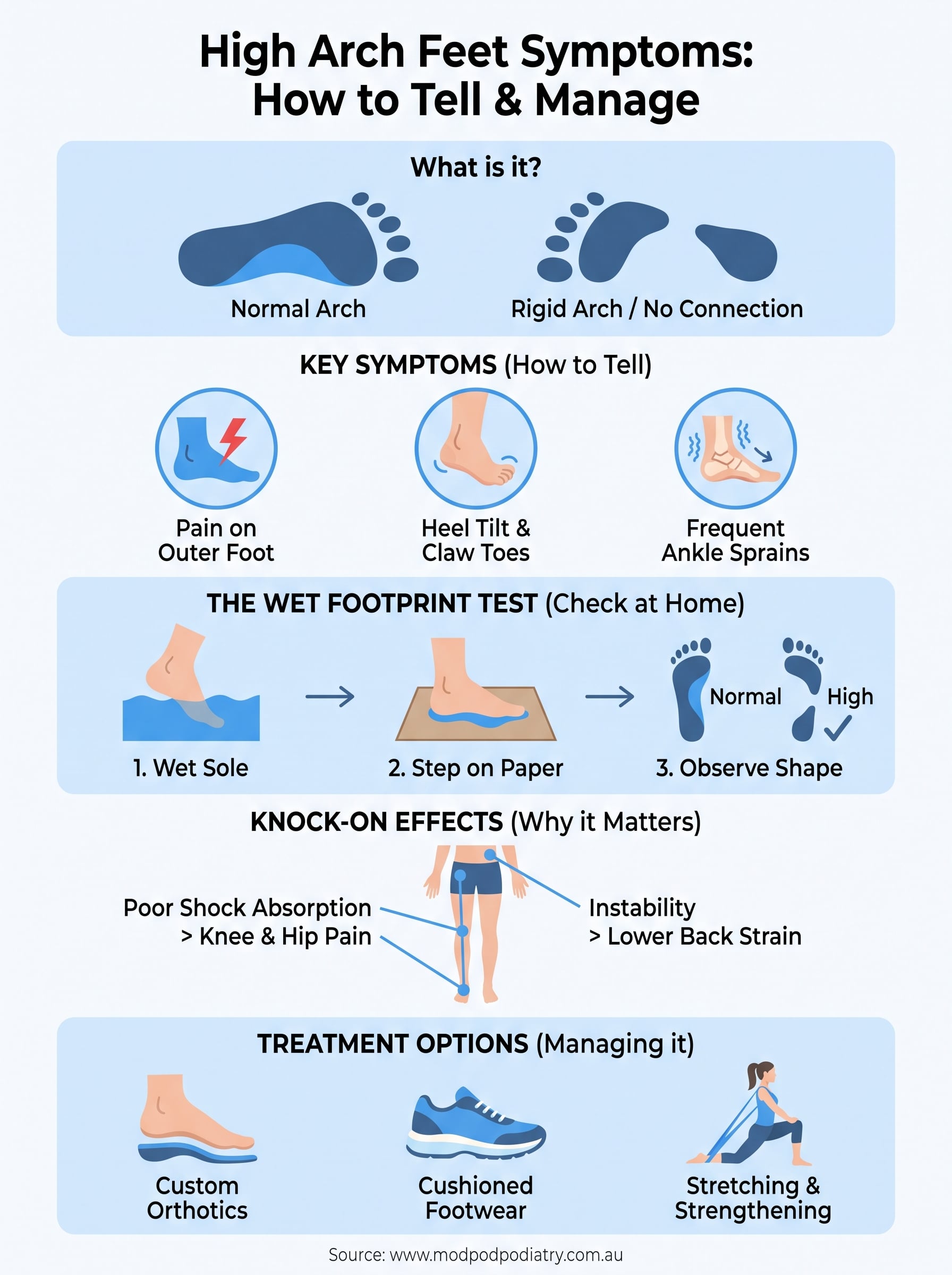 high arch feet symptoms infographic