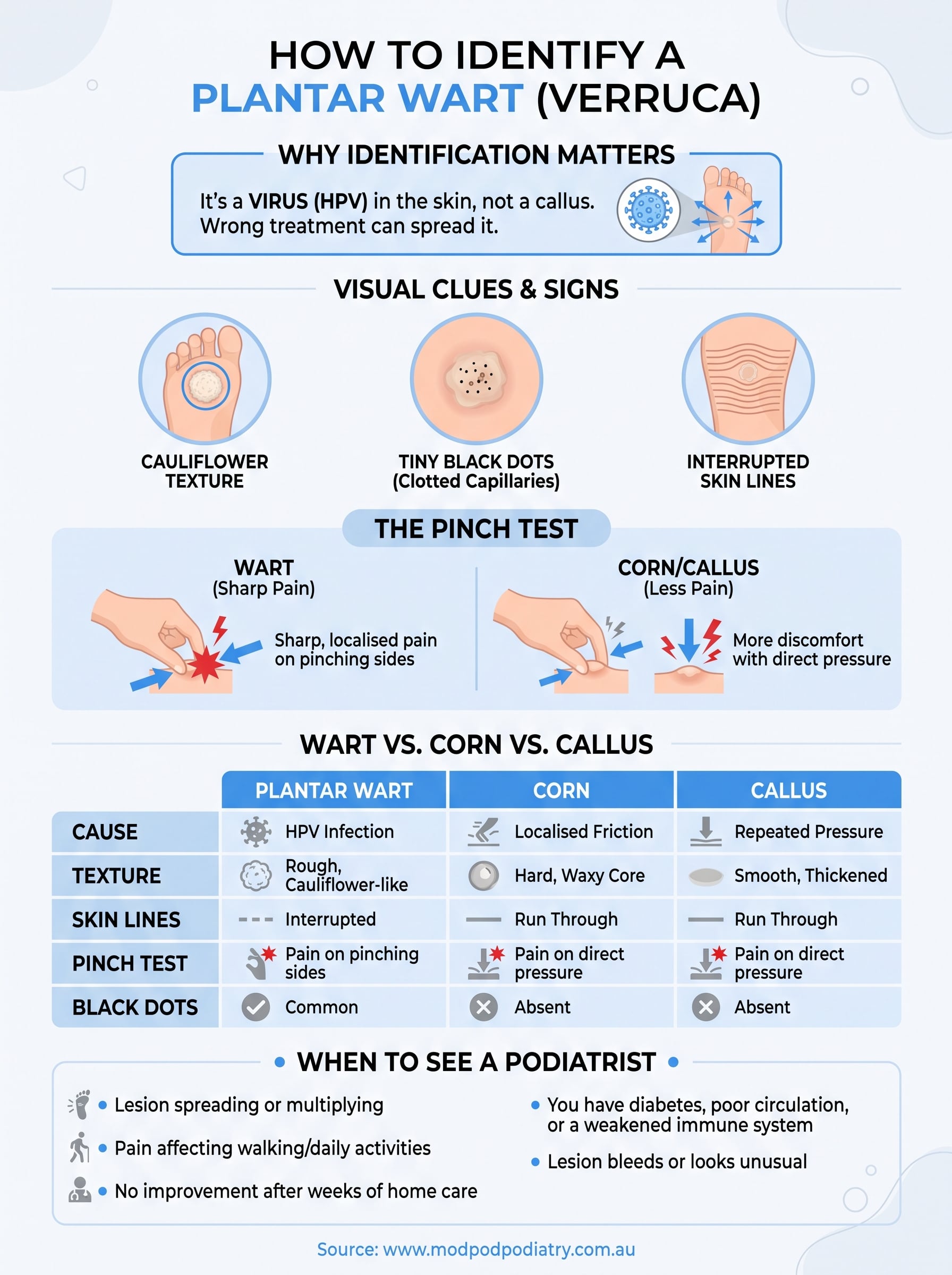 how to identify a plantar wart infographic