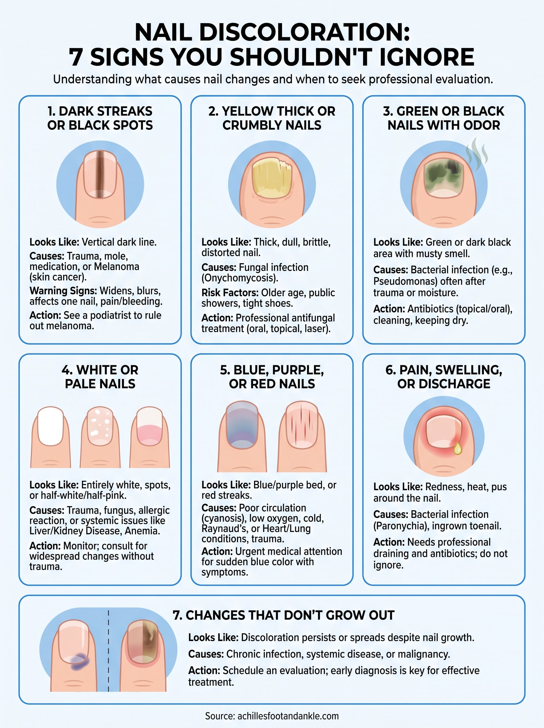 what causes nail discoloration infographic