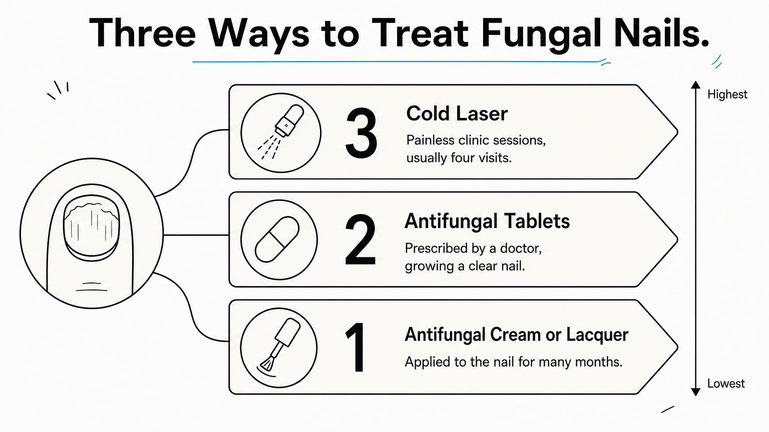 A three-step ladder showing cream or lacquer, tablets and cold laser as treatment levels for fungal nails.