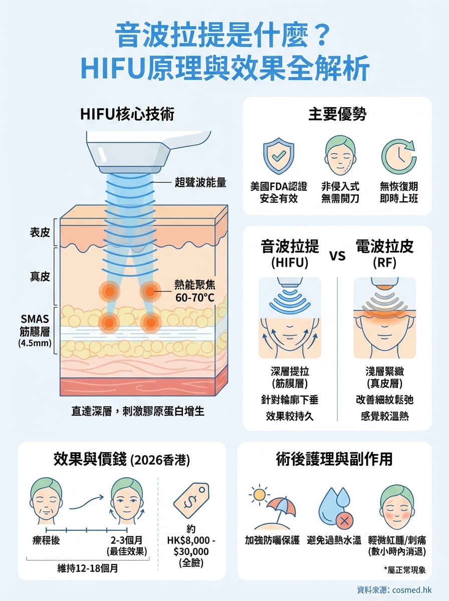 音波拉提是什麼 infographic