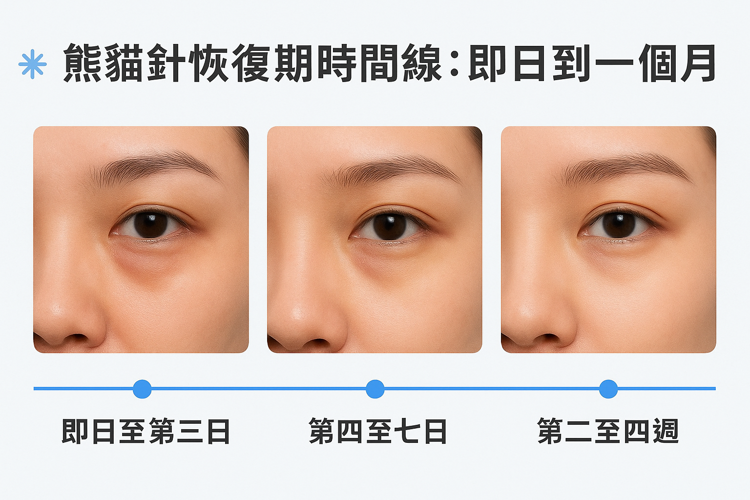 熊貓針恢復期時間線：即日到一個月
