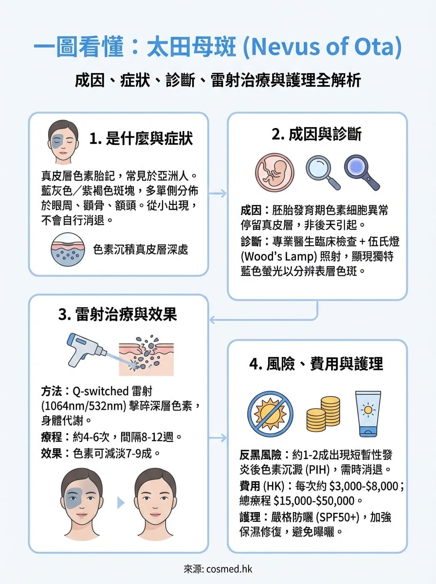太田母斑是什麼 infographic
