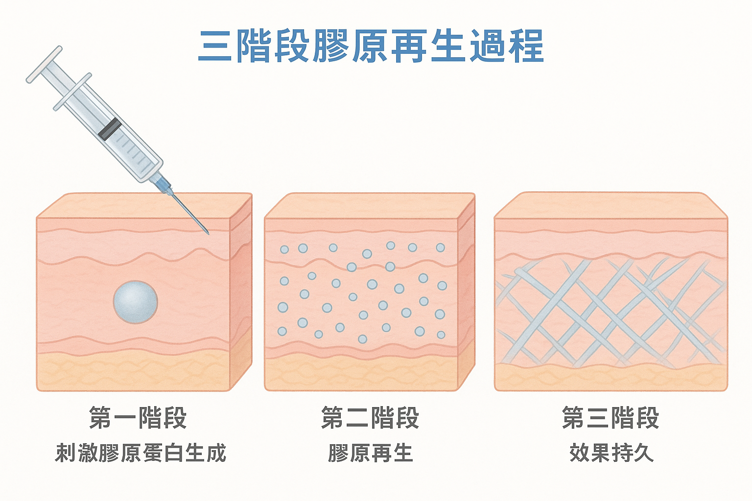 三階段膠原再生過程