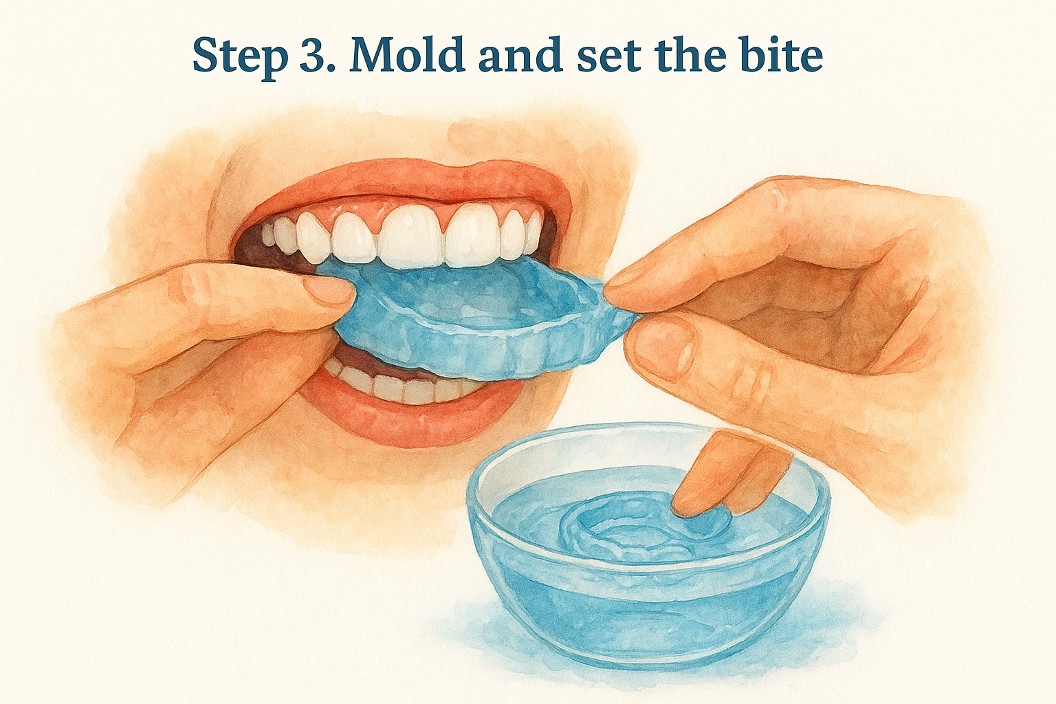 Step 3. Mold and set the bite