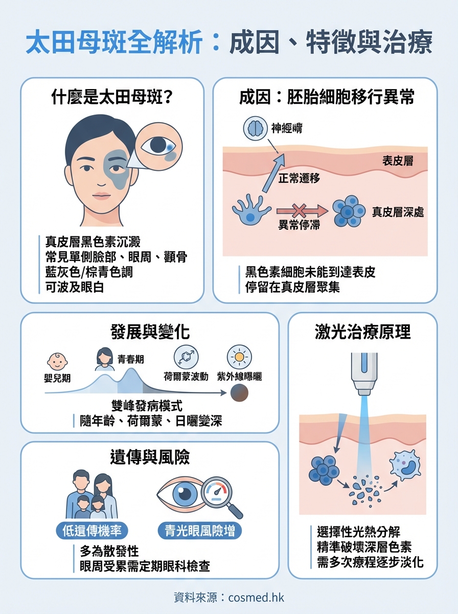 太田母斑成因 infographic