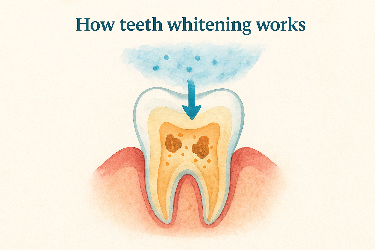 How teeth whitening works