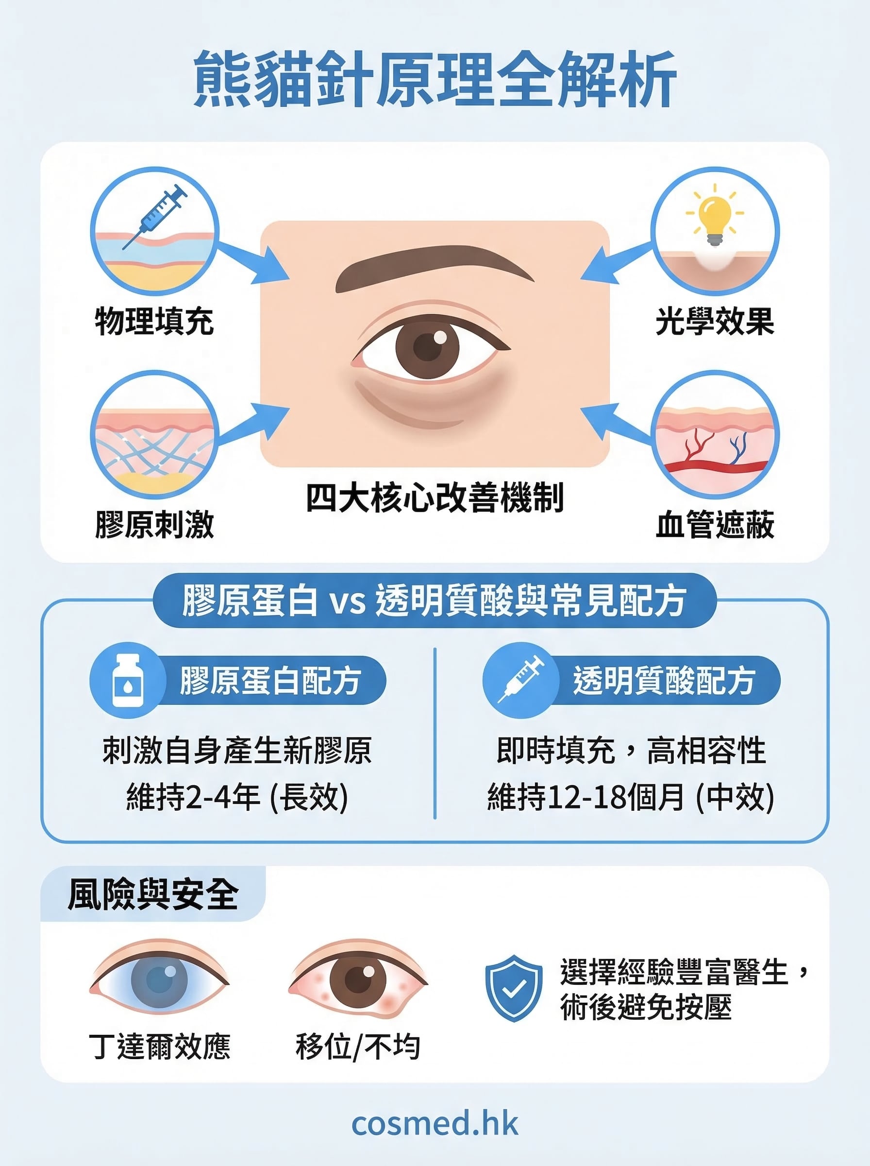 熊貓針原理 infographic