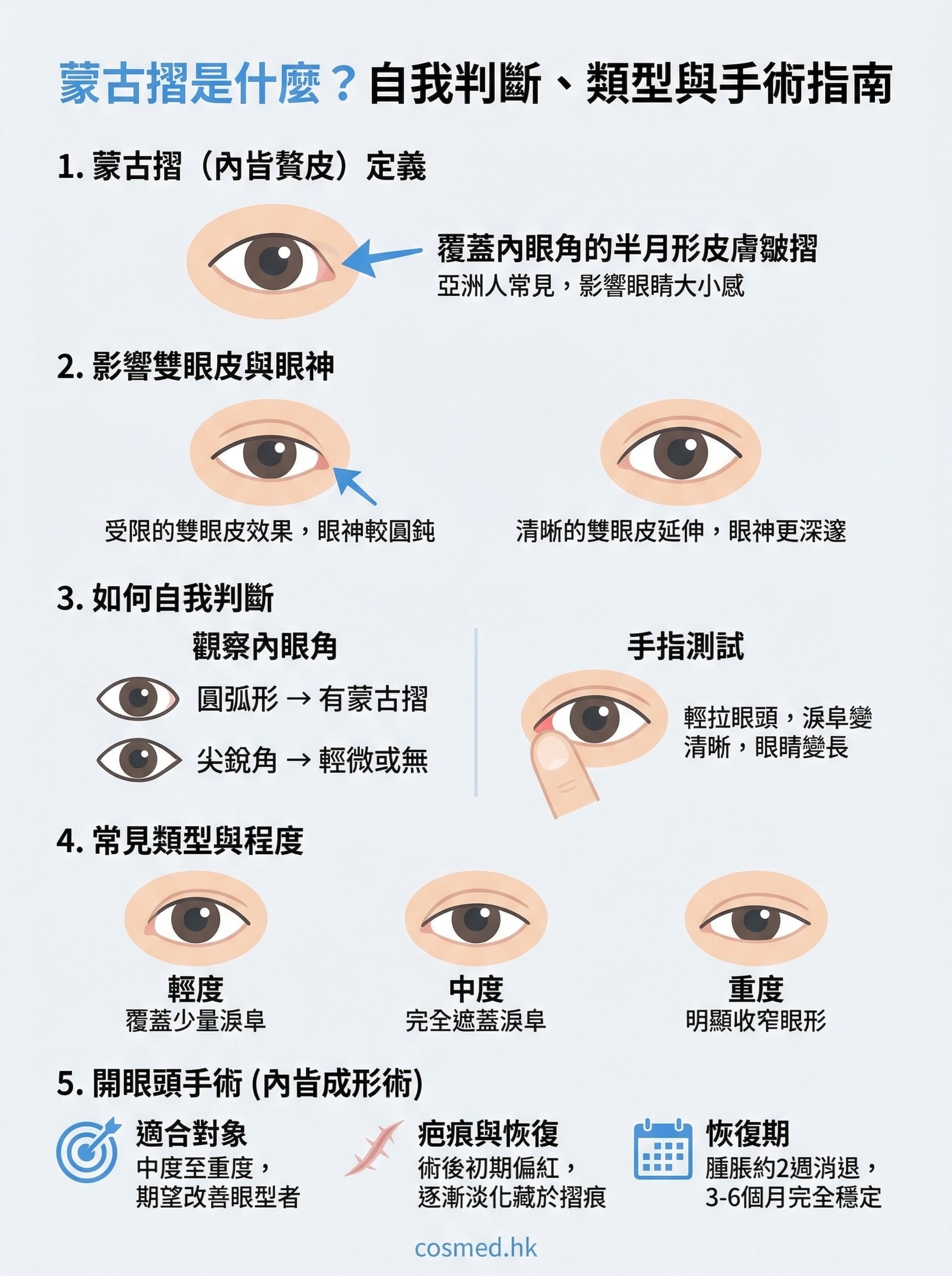 蒙古摺是什麼?跟雙眼皮有關嗎:自我判斷、類型、開眼頭手術疤痕與恢復期一次懂 - COSMED 映匯醫學集團