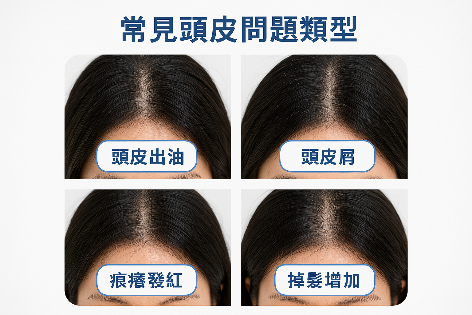 常見頭皮問題類型